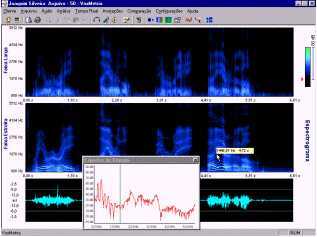 VoxMetria Screenshot